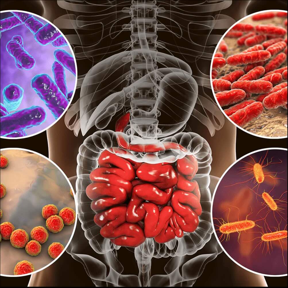 WEAK GUT BARRIER= INFLAMMATION